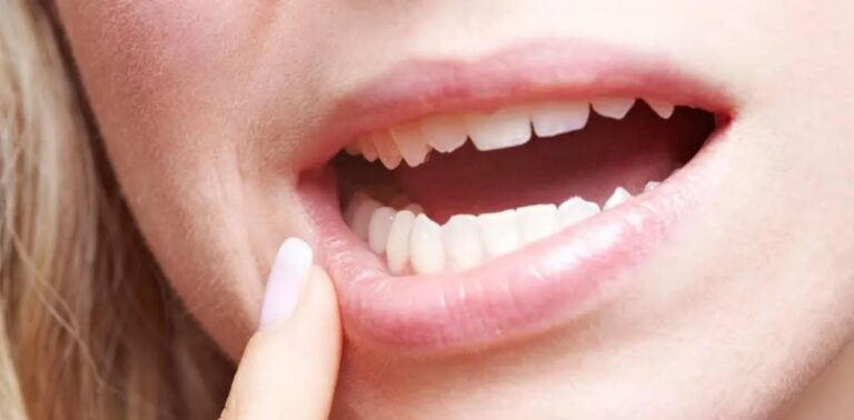 Gum Disease Warning Signs You Shouldn’t Ignore